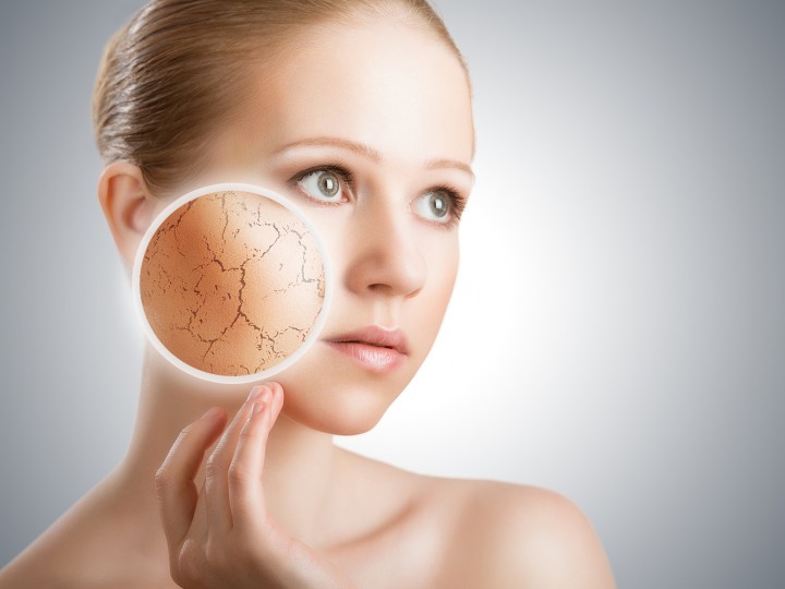 concept of cosmetic skin care. face of young woman with dry ski
