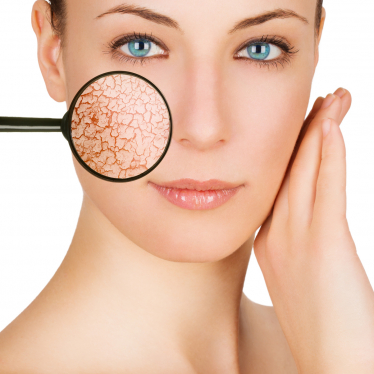 Beautiful young woman with cracked skin