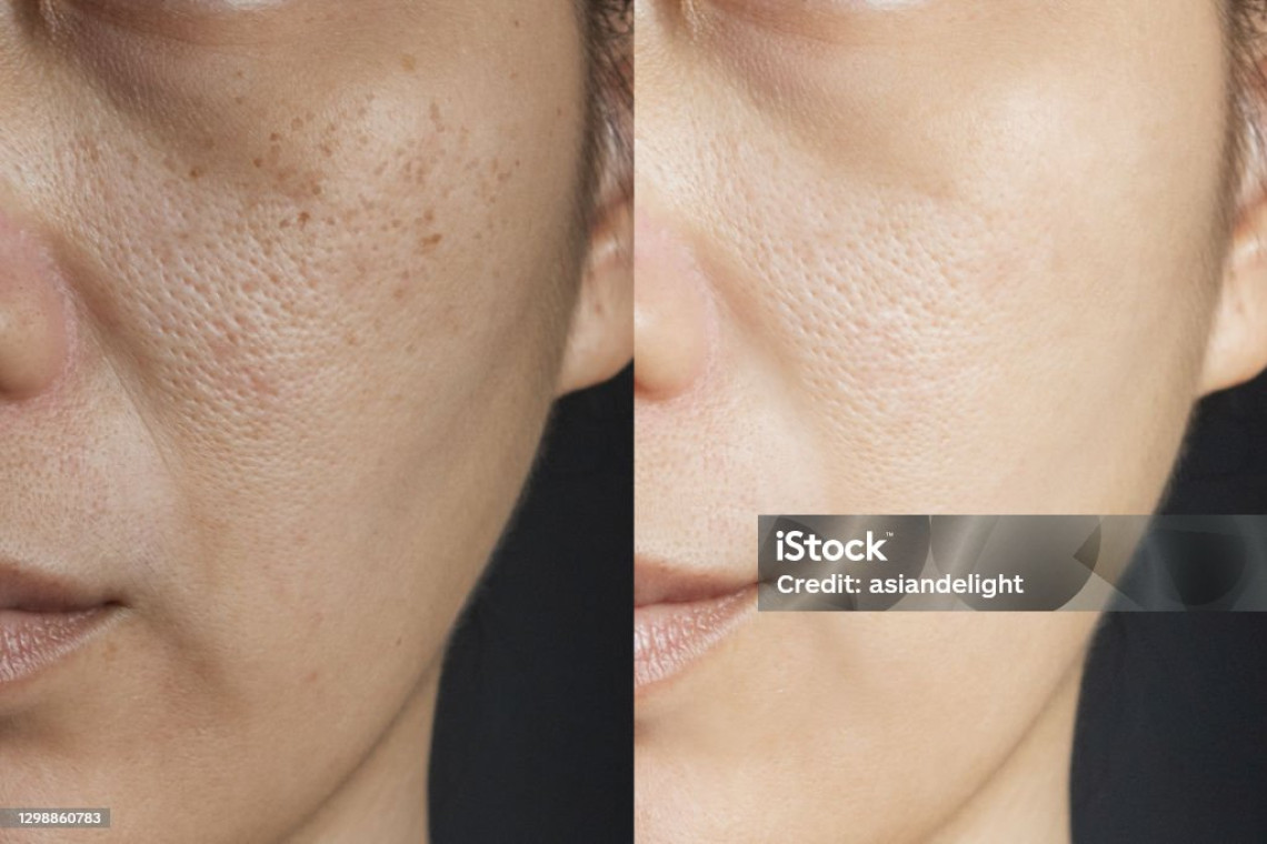 istockphoto-1298860783-1024x1024