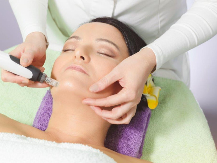 Microneedling