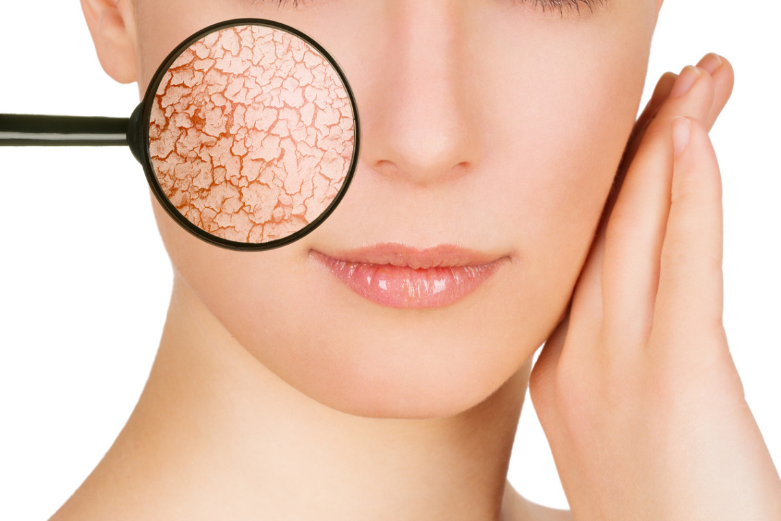 Beautiful young woman with cracked skin