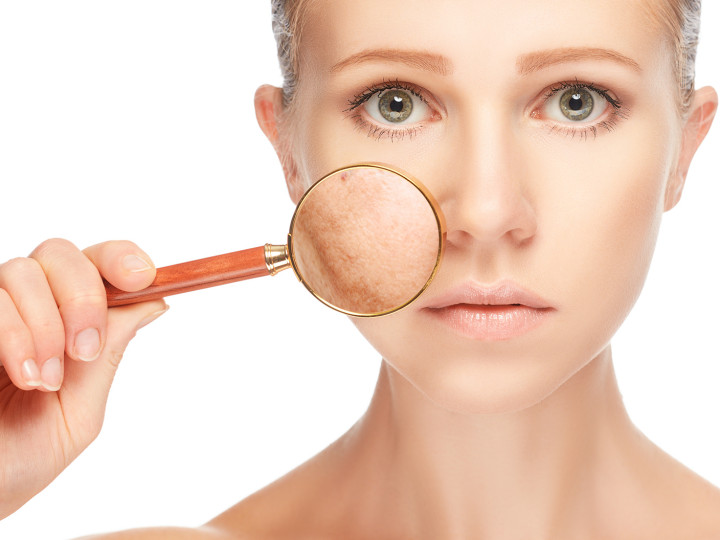 concept skincare. Skin of woman with magnifier before and after the procedure